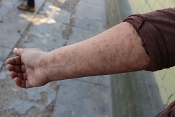 CON LLAGAS Y METALES EN LA SANGRE: ASÍ DEJÓ GRUPO MÉXICO A GENTE EN SONORA