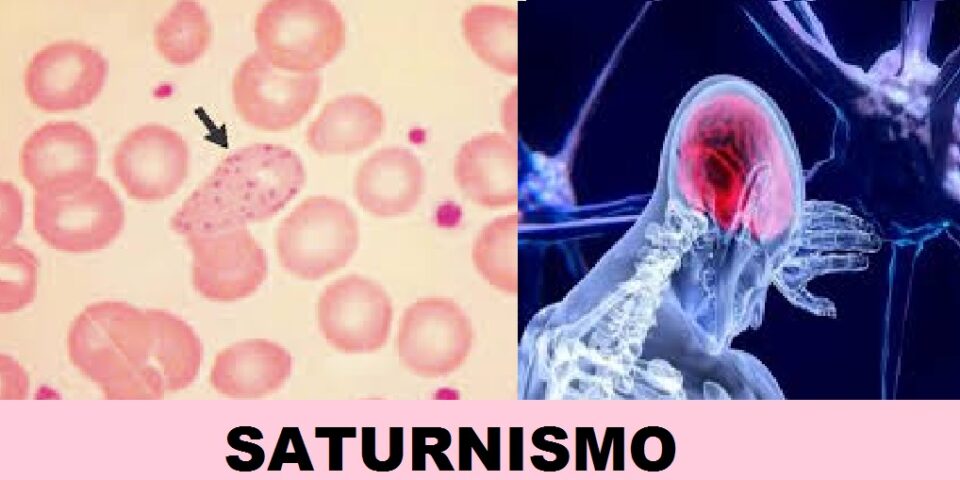 MEGAMINERÍA: SATURNISMO, DATOS QUE ASUSTAN.                              (Los niños los más afectados)